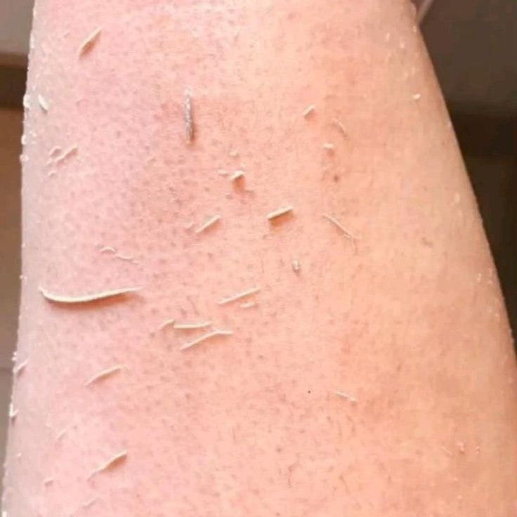 Close-up of skin showing dead skin cells being removed after using House of Argan Moroccan kessa glove exfoliation treatment
