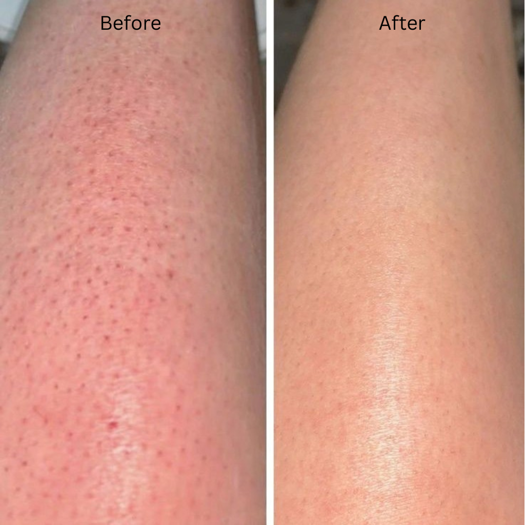 House of Argan Moroccan Soap before and after skincare results showing smoother and more even-looking skin