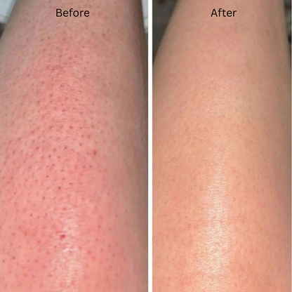 House of Argan Moroccan Soap before and after skincare results showing smoother and more even-looking skin